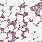 Immunohistochemical staining of human bone marrow shows moderate cytoplasmic positivity in hematopoietic cells.