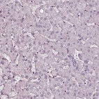 Immunohistochemical staining of human liver shows no positivity in hepatocytes as expected.