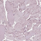 Immunohistochemical staining of human skeletal muscle shows no positivity in myocytes as expected.