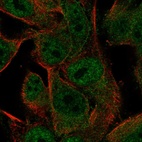 Anti-PCDHGA2 Antibody