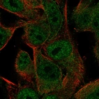 Immunofluorescent staining of human cell line SK-MEL-30 shows localization to nucleoplasm, plasma membrane & cytosol.