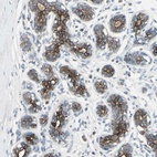 Anti-TIMM21 Antibody