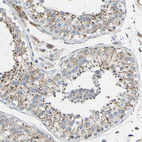 Anti-GLT8D1 Antibody
