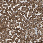 Immunohistochemical staining of human liver shows strong granular cytoplasmic positivity in hepatocytes.