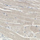 Immunohistochemical staining of human skeletal muscle shows very weak cytoplasmic positivity in myocytes.