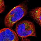 Immunofluorescent staining of human cell line A-431 shows localization to mitochondria.