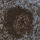 Anti-CD74 Antibody