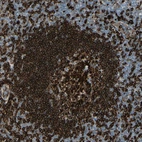 Anti-CD74 Antibody