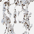 Anti-CD74 Antibody