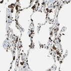 Immunohistochemical staining of human lung shows strong cytoplasmic positivity in macrophages.