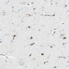 Immunohistochemical staining of human cerebral cortex shows strong cytoplasmic positivity in microglia.