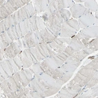 Immunohistochemical staining of human skeletal muscle shows no positivity in striated muscle fibers as expected.