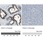 Anti-FOLH1 Antibody