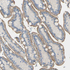 Anti-FOLH1 Antibody