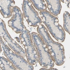 Immunohistochemical staining of human duodenum shows moderate positivity in apical membrane in glandular cells.