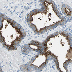 Anti-FOLH1 Antibody