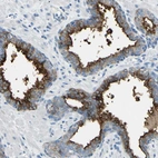 Immunohistochemical staining of human prostate shows strong positivity in apical membrane in glandular cells.