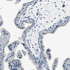 Immunohistochemical staining of human placenta shows no positivity in trophoblastic cells as expected.