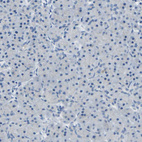 Anti-FOLH1 Antibody