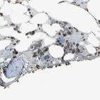Immunohistochemical staining of human bone marrow shows high expression.
