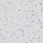 Anti-PSTPIP1 Antibody