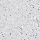 Immunohistochemical staining of human cerebral cortex shows low expression as expected.
