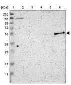 Lane 1: Marker [kDa] 230, 130, 95, 72, 56, 36, 28, 17, 11_br/_Lane 2: Human cell line RT-4_br/_Lane 3: Human cell line U-251MG sp_br/_Lane 4: Human plasma (IgG/HSA depleted)_br/_Lane 5: Human liver tissue_br/_Lane 6: Human tonsil tissue