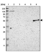 Anti-PSTPIP1 Antibody