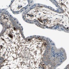 Anti-AFP Antibody