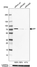Western blot analysis in Hep-G2 cells transfected with control siRNA, target specific siRNA probe #1 and #2, using Anti-AFP antibody. Remaining relative intensity is presented. Loading control: Anti-GAPDH.
