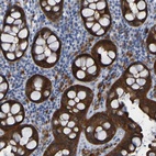 Anti-ARHGEF16 Antibody