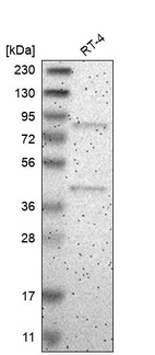 Western blot analysis in human cell line RT-4.