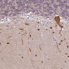 Immunohistochemical staining of human cerebellum shows strong cytoplasmic positivity in Purkinje cells.