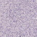 Immunohistochemical staining of human pancreas shows no cytoplasmic positivity in exocrine glandular cells as expected.