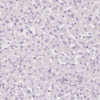 Immunohistochemical staining of human liver shows no cytoplasmic positivity in hepatocytes as expected.