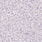 Immunohistochemical staining of human liver shows no cytoplasmic positivity in hepatocytes as expected.