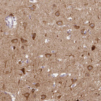Immunohistochemical staining of human cerebral cortex shows strong cytoplasmic positivity in neurons.