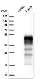 Western blot analysis in control (vector only transfected HEK293T lysate) and PIANP over-expression lysate (Co-expressed with a C-terminal myc-DDK tag (~3.1 kDa) in mammalian HEK293T cells, LY407009).
