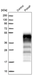 Western blot analysis in control (vector only transfected HEK293T lysate) and PIANP over-expression lysate (Co-expressed with a C-terminal myc-DDK tag (~3.1 kDa) in mammalian HEK293T cells, LY407009).