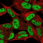 Immunofluorescent staining of human cell line SH-SY5Y shows localization to nucleoplasm.