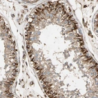 Anti-TRAF2 Antibody