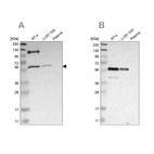 Western blot analysis using Anti-TRAF2 antibody HPA010634 (A) shows similar pattern to independent antibody HPA009972 (B).