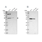 Western blot analysis using Anti-TRAF2 antibody HPA010634 (A) shows similar pattern to independent antibody HPA009972 (B).