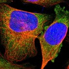 Immunofluorescent staining of human cell line U-2 OS shows localization to cytosol.