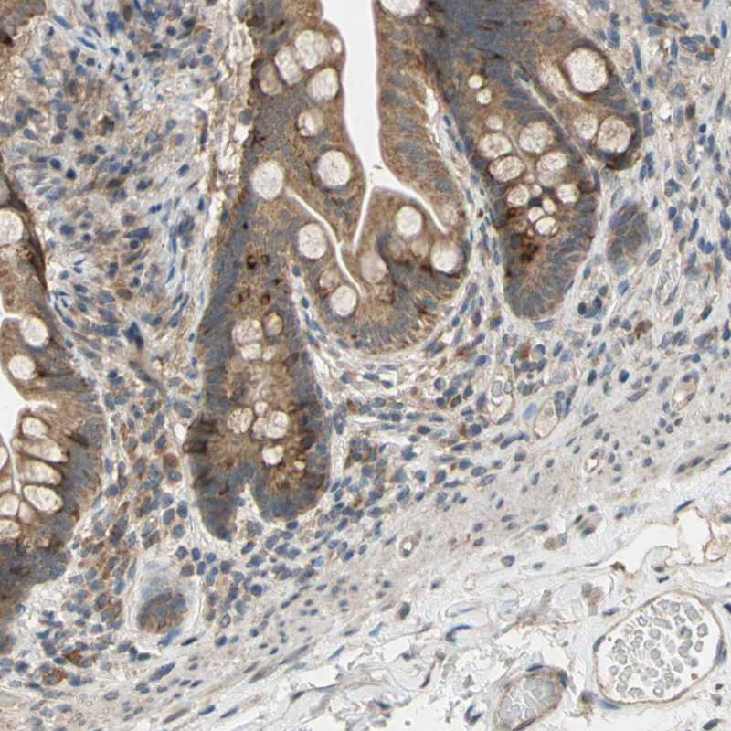 Anti-CD164 Antibody