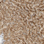 Anti-FAM189A1 Antibody