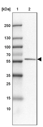 Lane 1: Marker [kDa] 250, 130, 100, 70, 55, 35, 25, 15, 10_br/_Lane 2: Human Liver tissue