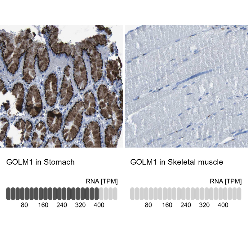 Anti-GOLM1 Antibody