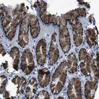 Immunohistochemical staining of human stomach shows high expression.