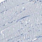 Immunohistochemical staining of human skeletal muscle shows low expression as expected.